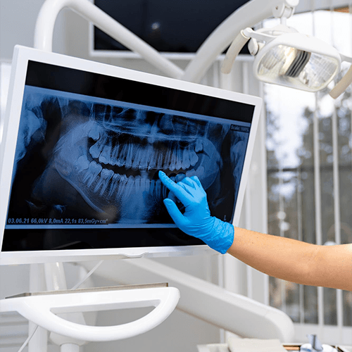 Digital X-ray System