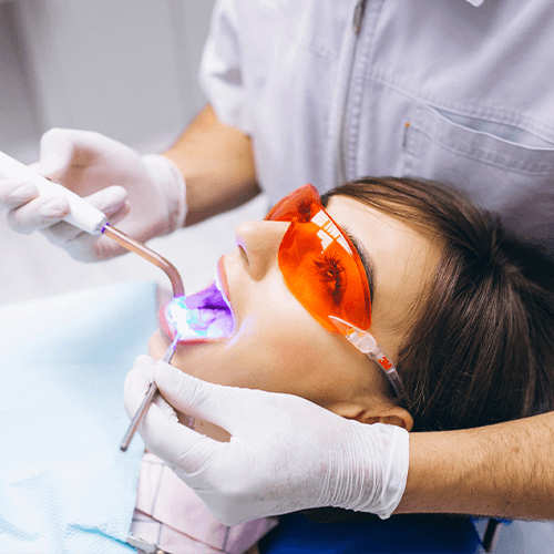 Teeth Whitening / Bleaching